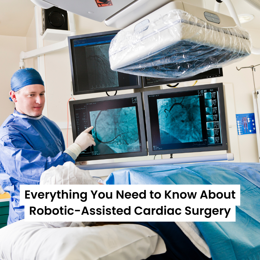 Everything You Need to Know About Robotic-Assisted Cardiac Surgery